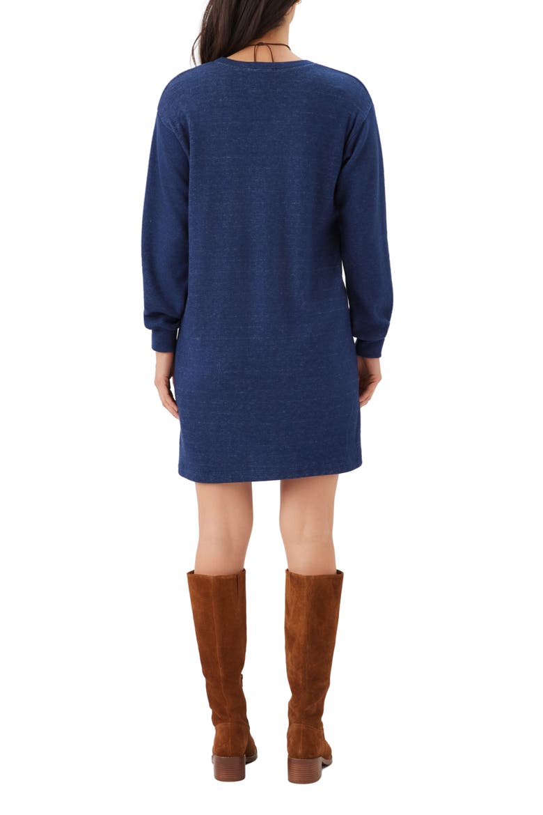 V-Neck Button Detail Minidress